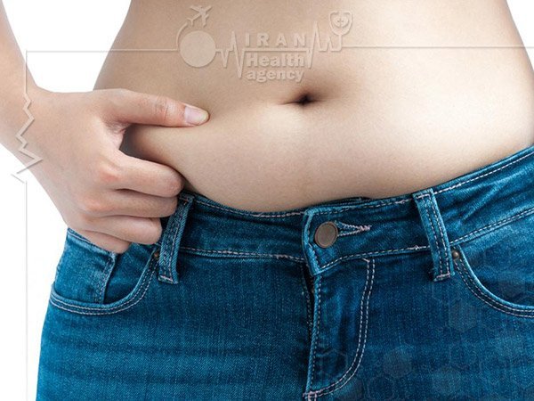 before abdominoplasty