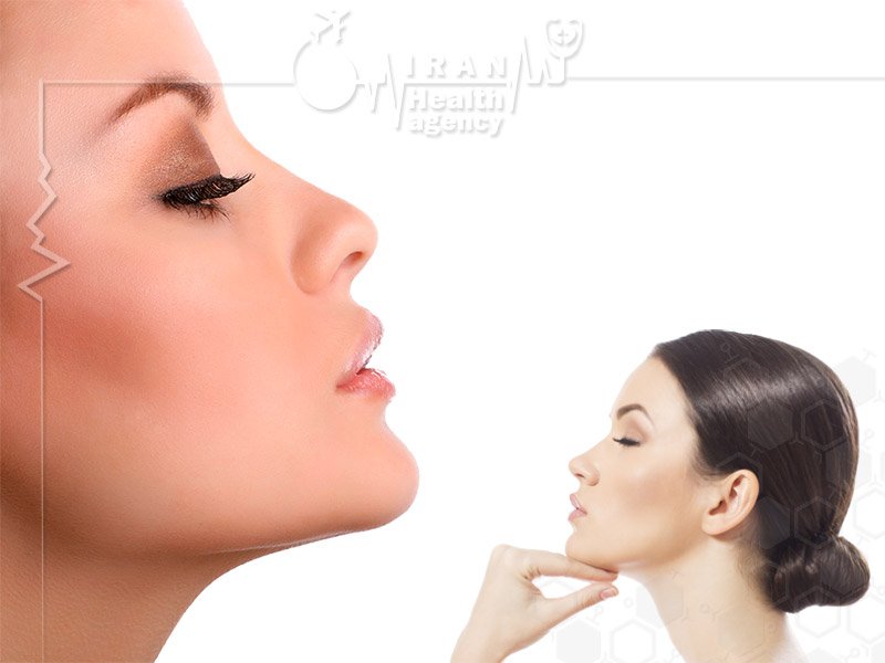 rhinoplasty in iran by iran health agency
