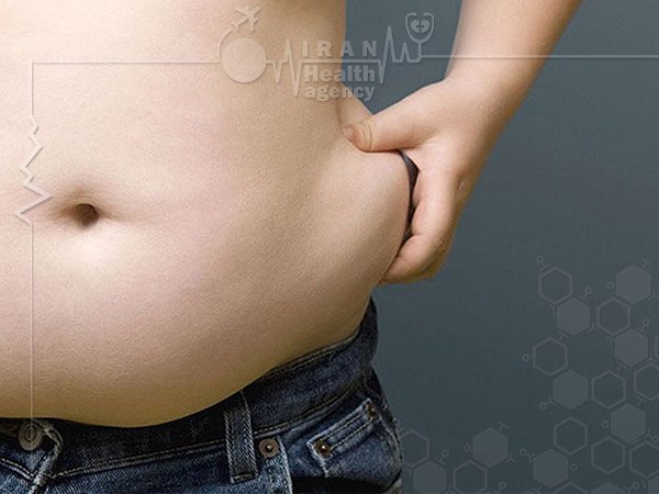 tummy tuck surgery in Iran