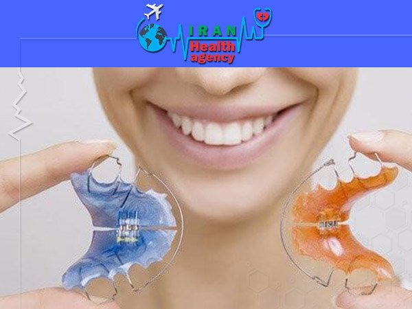 Removable Orthodontics