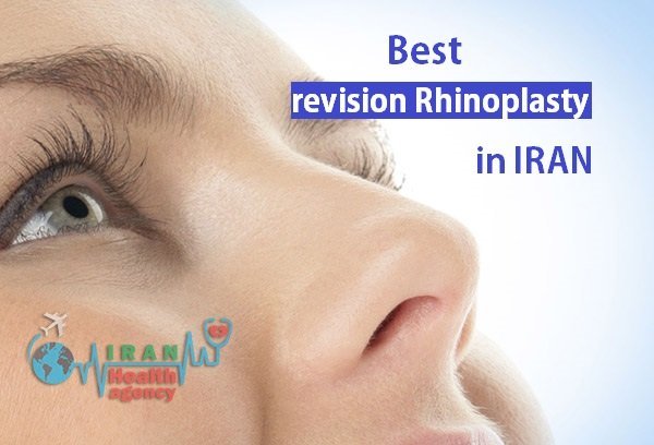 best reviseion rhinoplasty
