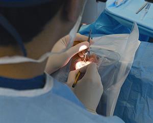 phaco surgery in iran