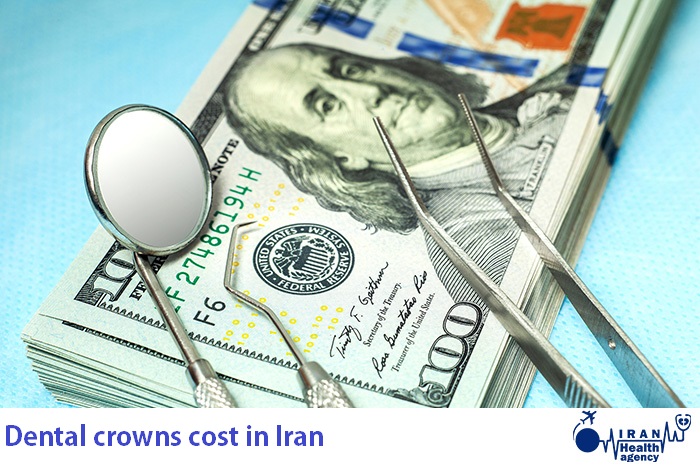 Dental crowns cost in Iran