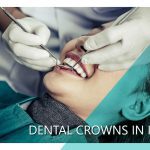 Dental crowns in Iran