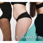 Fat transfer in Iran Fat transfer in Iran