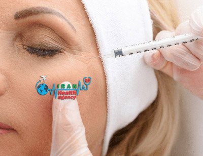 How is the procedure of Botox in Iran