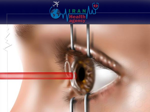 Lasik eye surgery weakens your eyes