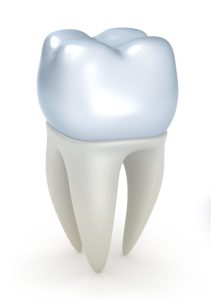 Lifespan of dental crown