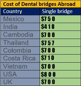 Dental bridge cost in different countries