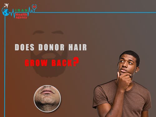 does donor hair grow back