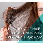 How to stop hair loss? Different non-surgical treatment for hair loss