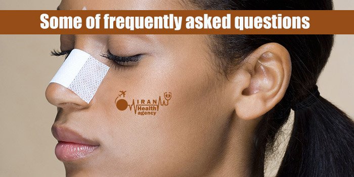 Some of frequently asked questions about after rhinoplasty