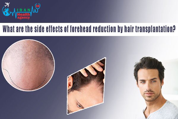 What are the side effects of forehead reduction by hair transplantation