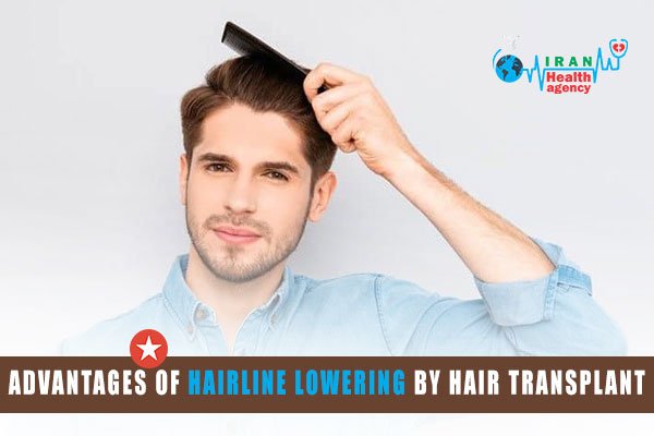 advantages of hairline lowering by hair transplant