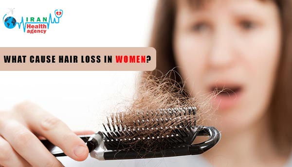 hair loss in women