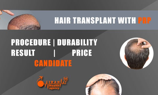 hair transplant without surgery