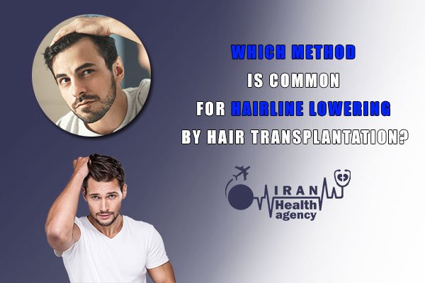 methods of hairline lowering
