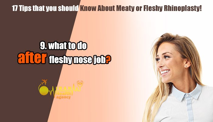 what to do after fleshy nose job
