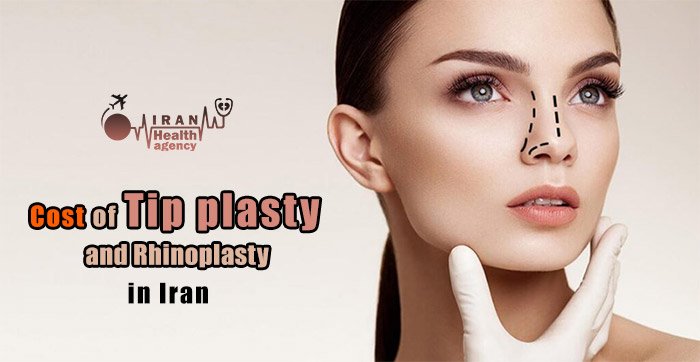 Cost of tip plasty in Iran