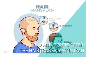 Do and don'ts after the hair transplant in Iran