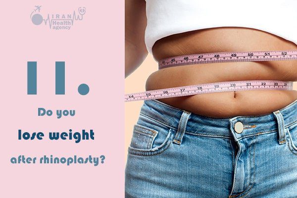 Do you lose weight after rhinoplasty
