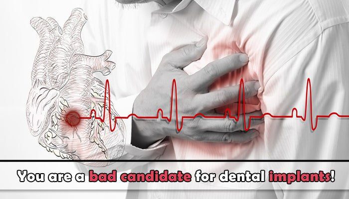 Heart related conditions dental implants