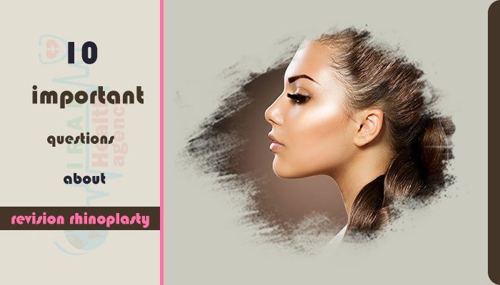 When can you do revision rhinoplasty