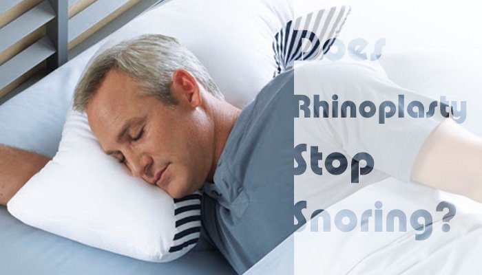 rhinoplasty to stop snoring