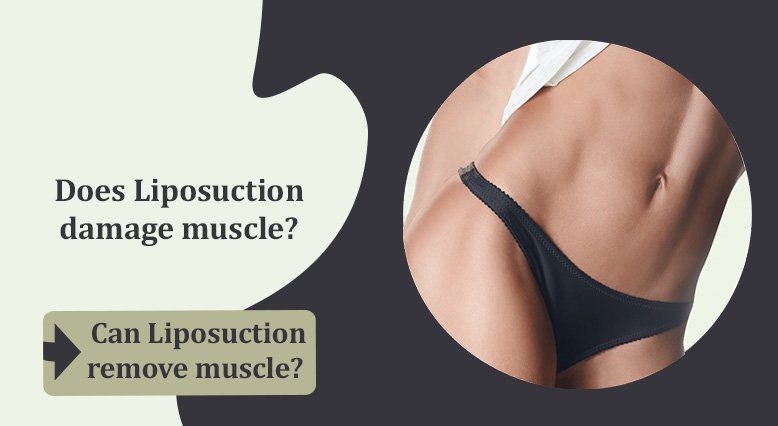 Does Liposuction damage muscle