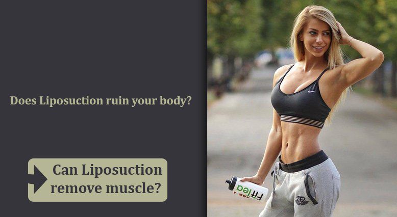 Does Liposuction ruin your body