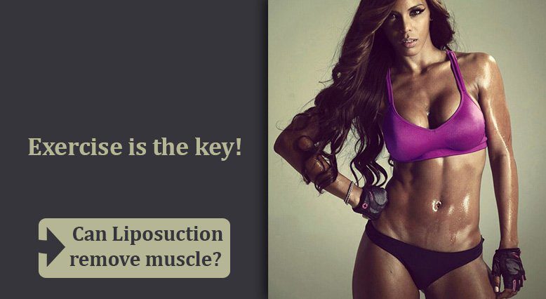 Exercise and liposuction