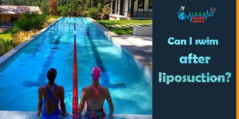 Is swimming after liposuction a problem