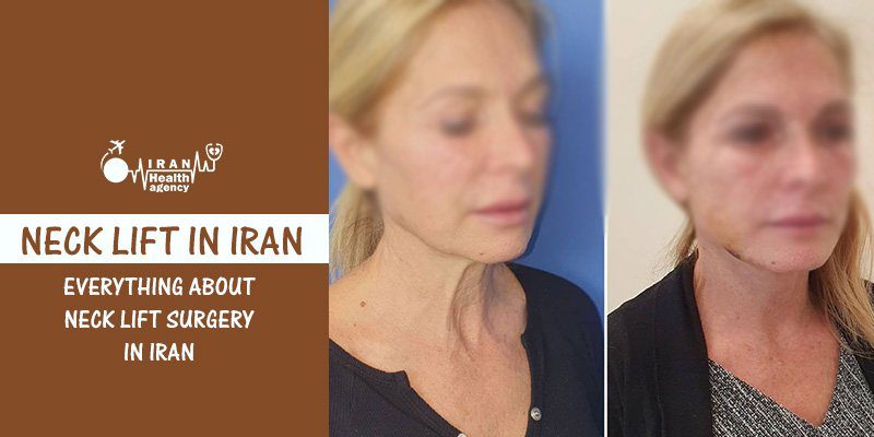 Cost of neck lifts in Iran
