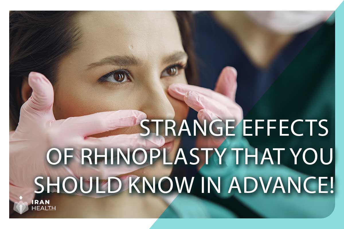 Strange effects of rhinoplasty that you should know in advance!