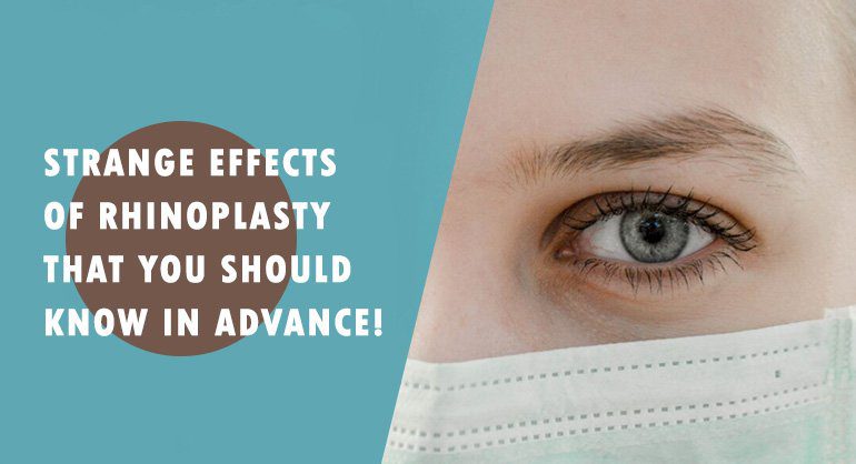 rhinoplasty affect eyes