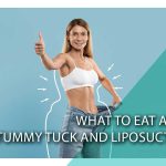 What to eat after tummy tuck and liposuction?