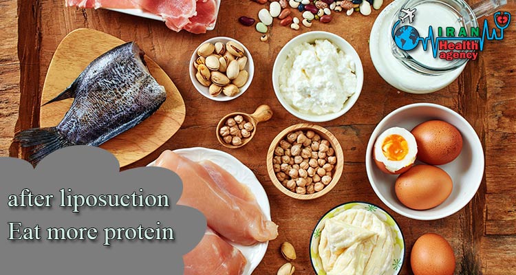 after liposuction Eat more protein 