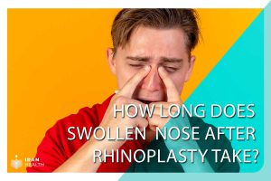 swollen nose after rhinoplasty