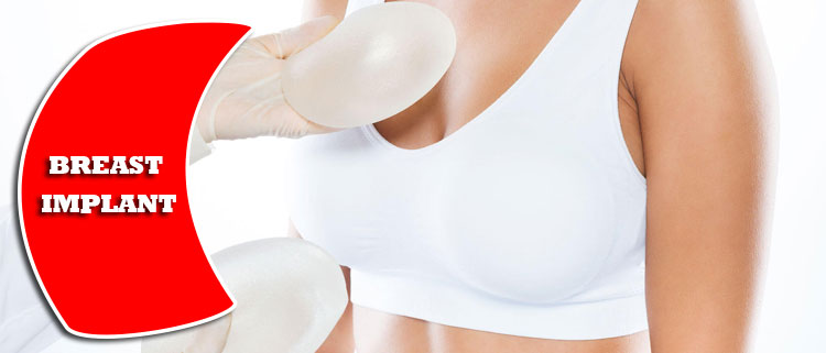 reasons about breast implant