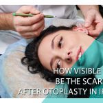 How visible will be the scarring after otoplasty in Iran?
