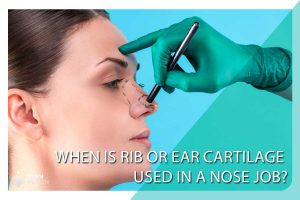 When is rib or ear cartilage used in a nose job?