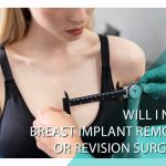 Will I need breast implant removal or revision surgery?