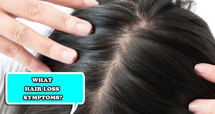 What hair loss symptoms?