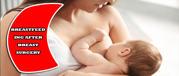 Breastfeeding after breast surgery