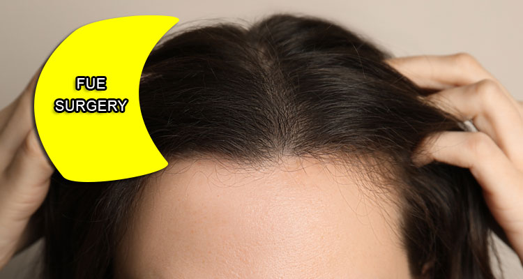Tips on hair transplantation in Iran after FUE surgery