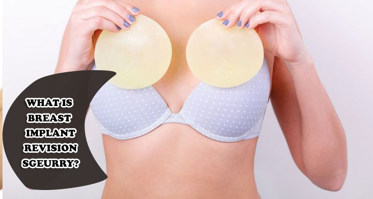 What is breast implant revision sgeurry?