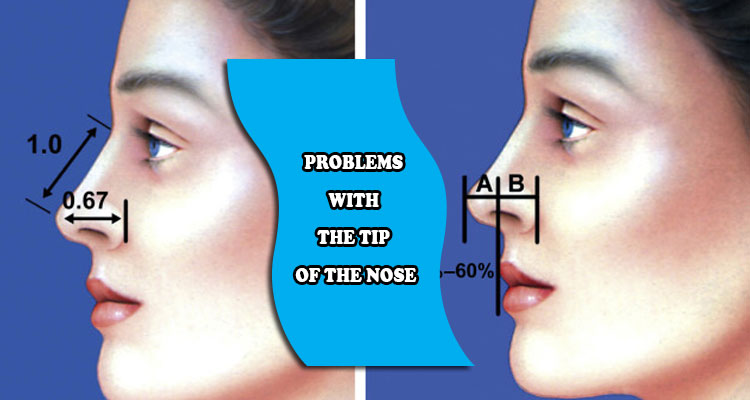 Problems with the tip of the nose