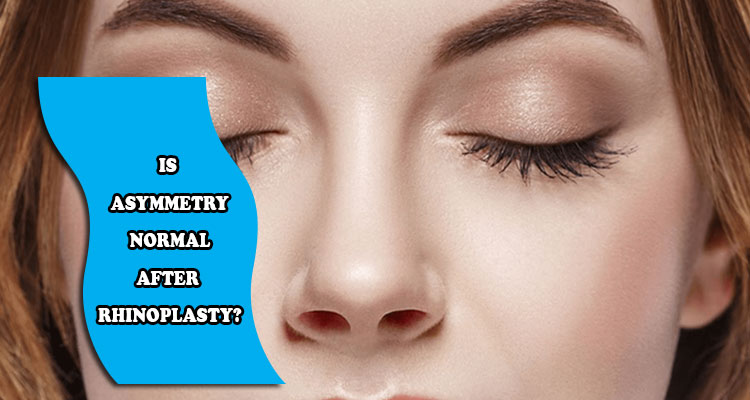 Is asymmetry normal after rhinoplasty?