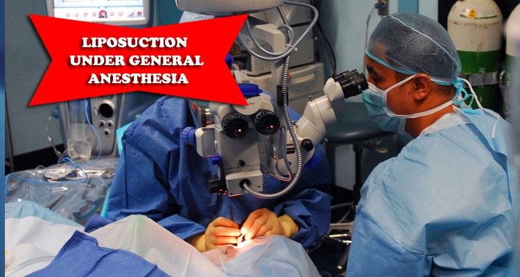 under general anesthesia