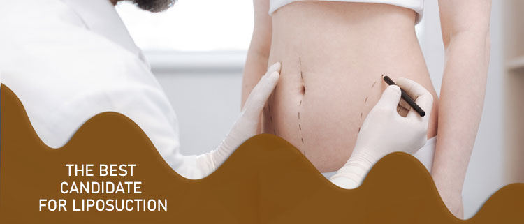 The best candidate for liposuction